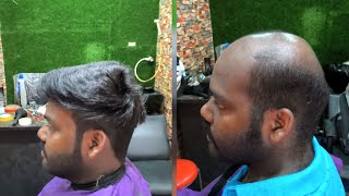 Tamil Nadu best hair fixing saloon in madhavaram chennai 9551083058 [upl. by Idnis632]