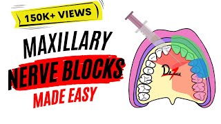 Maxillary Nerve Block Anesthesia For Dental Procedures [upl. by Odericus224]