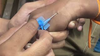 Intravenous Cannulation  iv cannula fixed  learn to intravenous cannula [upl. by Scheers]