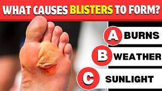 Blister Basics Test Your First Aid Knowledge [upl. by Aenal201]