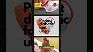 Protect Your Diabetic Foot Ulcer with Our Waterproof Cover [upl. by Terri]