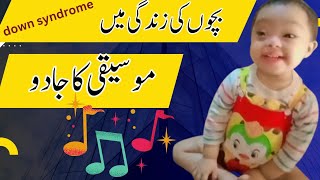 down syndrome musicbecho pr music ka asrdown syndrome music therapy SmilewithUnaisa [upl. by Rivers928]