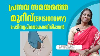 പ്രസവ സമയത്തെ മുറിവ് പേടിസ്വപ്നമാകാതിരിപ്പാൻ  DRSUSAN JOSEPH [upl. by Sosna387]