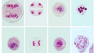 COLLECTION OF MEIOTIC CELL DIVISION PHOTOMICROGRAPHS [upl. by Karisa]