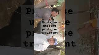 Short ytshort treatment of uterine prolapse [upl. by Eatnod802]