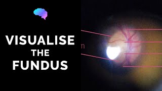 Fundoscopy  How to Visualise the Fundus  Direct Ophthalmoscopy  OSCE Guide  UKMLA  CPSA [upl. by Moritz283]