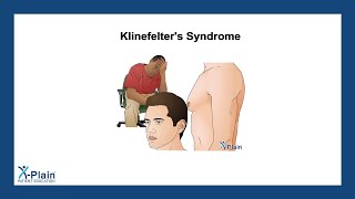 Klinefelters Syndrome [upl. by Alled]