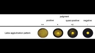 Latex Agglutination Test  Amrita University [upl. by Ardnuasal]