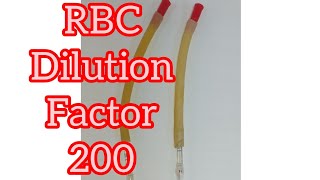 RBC Dilution factor 200 [upl. by Zimmermann]