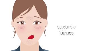 ลดมัน กระชับรูขุมขน BIODERMA Sebium Pore Refiner [upl. by Oiluarb643]