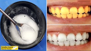 No Hay Necesidad De Ir Al Dentista Blanquear Los Dientes En Casa Con Sólo Estos 2 Ingredientes [upl. by Lahcear]