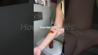 Will Sudocrem Help if Your Arm is Bleeding Lets Find Out [upl. by Hait459]