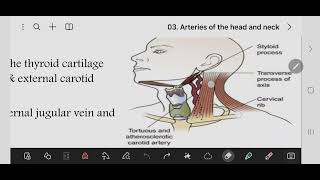 cmmon carotid artery and ICC and ECA [upl. by Scott]