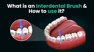 What is an Interdental Brush and How to use it  3D Step by Step Guide [upl. by Oer]