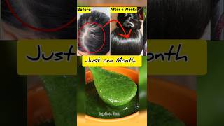 😱உங்க தலையில் முடி இல்லையா Just One Month 🔥Get New Hair😱 baldness tips [upl. by Daveda]