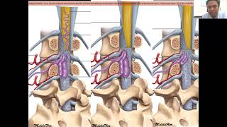 Case of spinal cord myelopathy being treated as longitudinally extensive transverse myelitis [upl. by Dana]