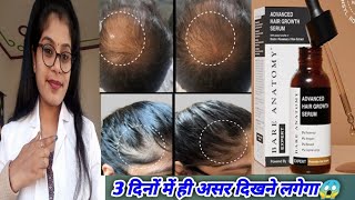 Innovist bare anatomy advanced hair growth serum honest reviewinnovist hair growth serum uses hindi [upl. by Thetis]