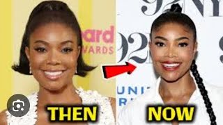 SHOCKING Gabrielle Union Gets Plastic Surgery  Now Shes Looks Unrecognizable [upl. by Kilar]