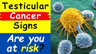 Hidden Dangers Testicular Cancer Warning Signs [upl. by Ayatnwahs962]