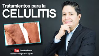 TRATAMIENTOS PARA LA CELULITIS ¿Como eliminar celulitis Dr Marino Dermatologo [upl. by Eitirahc]