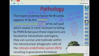 Lecture 1 Brucellosis  paediatric  اطفال  طب القادسية [upl. by Annoed552]