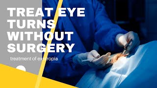 Treat eye turns without surgery  Vision Therapy for Exotropia [upl. by Lennard]