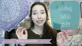 Living with EDS Spinal Instability [upl. by Wendell]