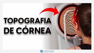 Topografia de córnea  DrGustavo Bonfadini [upl. by Doreen]