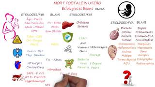 MORT FŒTALE IN UTERO 2è Partie  Étiologies et Bilans [upl. by Martsen697]