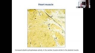 Myositis and Heart Disease with Dr Christina CharlesSchoeman [upl. by Aryas]