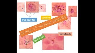 Malarial parasites identification within two minutes  Trophozoite Schizont Gametocyte Merozoite [upl. by Dahlstrom]