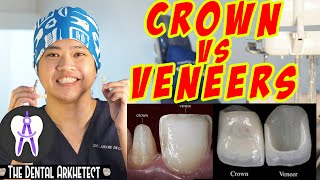 Kaibahan ng Dental Veneer at Crown Jacket veneer dentalcrown [upl. by Delos111]