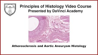 Atherosclerosis and Aortic Aneurysm Histology Cardiovascular 3 of 4 [upl. by Atiuqahs]