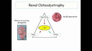 12DaysinMarch Renal Osteodystrophy for the USMLE Step One [upl. by Heise523]