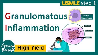 Granulomatous inflammation  What causes granulomatous inflammation  Pathology for USMLE step 1 [upl. by Shirlie]