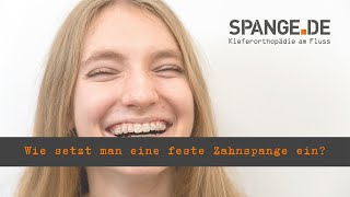 Wir setzen deine feste Zahnspange ein SPANGEDE erklärt [upl. by Eahsram]