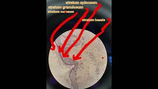 Layers of epidermisskindermapathHandEhistologypathologymedical [upl. by Eseryt229]