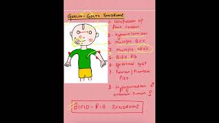 Gorlin Goltz syndrome  Bifid Rib syndrome  Oral Pathology  bds oralpathology syndromes mds [upl. by Kirkwood]