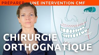 Information patient  Chirurgie orthognatique [upl. by Carlile]