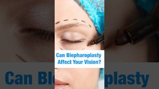 Can Blepharoplasty Affect Your Vision Dr Aniketh Venkataram Explains  The Venkat Center [upl. by Orapma]