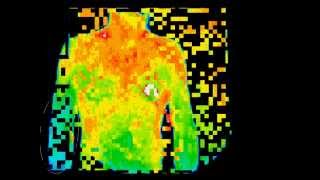 The Clinical Applications of Digital Thermal Imaging [upl. by Ellicul116]