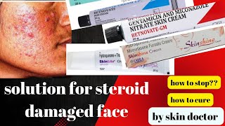 cure for fairness cream and steroid damaged face how to stop skinshineskinlite betnovate creams [upl. by Esdras]