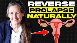 Healing Prolapsed Uterus amp PCOS Naturally with Barbara ONeill  Progesterone for Women’s Health [upl. by Airekat974]