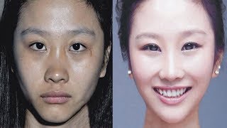 How to use Melacare Cream without any side effects for for fair whitening face Review in Hindi [upl. by Osnofedli]