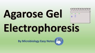 Agarose gel electrophoresis [upl. by Hakeber]