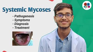 Histoplasmosis  Coccidioidomycosis  Paracoccidioidomycosis  Microbiology bangla lecture [upl. by Sanborne]