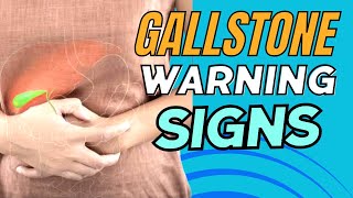 Gallbladder Disease Causes Symptoms and Effective Remedies [upl. by Einattirb]