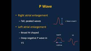 Pediatric ECG Interpretations [upl. by Ethelin516]