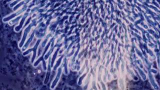 Clinical Mycology Direct Examination Series Aspergillus Hot Topic [upl. by Adnofal]