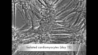 Enriched Cardiomyocytes  Beating from Day 1 [upl. by Dino]